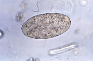 800px-Fasciolopsis_buski_egg_08G0039_lores